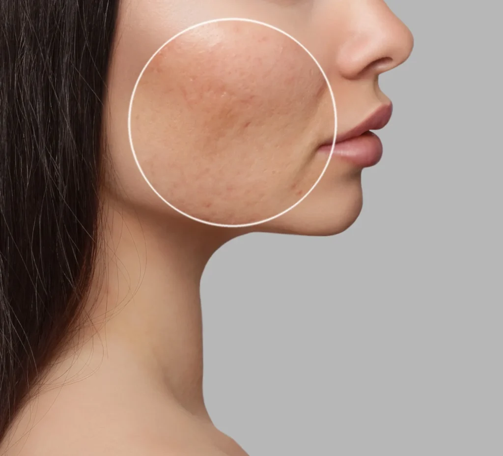 A woman with facial skin concerns before AgeJet PRISM Plasma anti-aging treatment at Coastal Glo Med Spa | Medical Aesthetics | Corpus Christi, TX